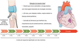 Exemplo de um protocolo para aplicação de pré-condicionamento isquémico remoto (figura elaborada com recurso ao Servier Medical Art). I: isquemia; PAs: pressão arterial sistólica; R: reperfusão.