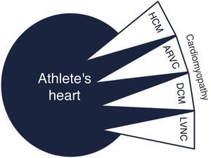 Overlap between cardiomyopathy and athlete