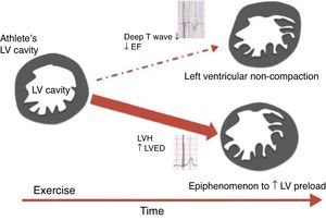 Scheme proposed for the significance of left ventricular trabeculation in athletes (adapted from 58). EF: ejection fraction; LV: left ventricular; LVED: left ventricular end-diastolic diameter; LVH: left ventricular hypertrophy.