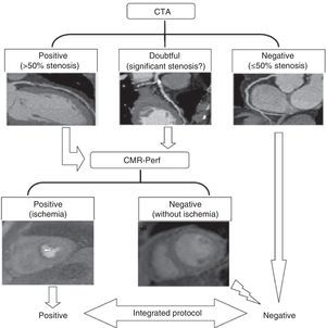 Algorithm for classification of stenosis by integration of CTA and CMR perfusion imaging data. CMR: cardiac magnetic resonance; CMR-Perf: cardiac magnetic resonance perfusion imaging; CTA: computed tomography angiography.