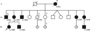 Pedigree of the reported Fabry disease patient and of her family. Squares indicate males, circles indicate females, solid black symbols indicate individuals diagnosed with Fabry disease; symbols with a diagonal line denote deceased individuals. Asterisks indicate a clinical or pedigree-based diagnosis of Fabry disease. Diamonds indicate healthy sibs of different genders, with their number specified by the cardinal inside the symbol. The arrow indicates the patient presented in our paper. Question-marks indicate individuals who have not been clinically or genetically assessed for Fabry disease. The two diagonal vertical lines originating from the same point indicate dizygotic twins. Year of birth is indicated by “b.”; age at death, in full years (“y”), is indicated by “d.”. Patient I-2 was reported to have died from “kidney disease”; patient II-1 was reported to have died from “cerebrovascular disease”, nine years after receiving a kidney transplant; patient II-5 had type 2 diabetes mellitus and died from acute stroke. All the affected males presented with the classical phenotype of Fabry disease. Patient II-3, who is followed at another hospital, started hemodialysis at age 35 and received a kidney transplant about two years later. Patients II-11 and III-9 live abroad and are also followed elsewhere. Patients II-2, II-10 and III-2, who are under our clinical care, started enzyme replacement therapy in 2005, 2002 and 2003, respectively. Neither of the two younger sisters of the proband