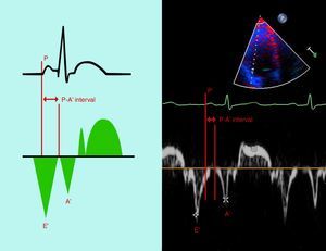 Measurement of the time from the onset of the P wave on the ECG to the beginning of the A′ wave on tissue Doppler imaging (PA′-TDI interval).