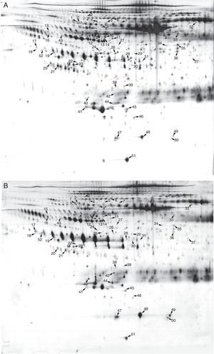 Two-dimensional electrophoresis analysis of the serum exosome proteome. Gels were visualized by silver staining. Arrows indicate differentially expressed proteins in Kawasaki disease (KD) patients with coronary artery dilatation (CAD) and healthy controls. Spot numbers correspond to proteins in Table 1. (A) Healthy controls; (B) KD patients with CAD.