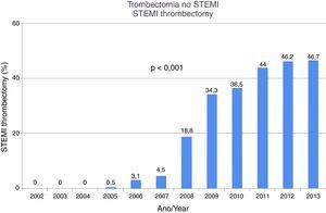 Trombectomia no STEMI.