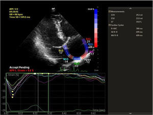 Right atrial longitudinal strain imaging.