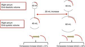 Interaction between right atrium size and strain.