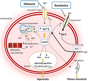 Alterações na homeostase do Ca2+ e na INaL na MCH e modo de atuação do diltiazem e ranolazina12,14,21 Legenda: ATP‐ adenosina trifosfato; ADP‐ adenosina monofosfato; CaMKII‐ proteína cinase II Ca2+/calmodulina dependente; INaL‐ corrente tardia de sódio; MEF2‐ fator 2 ativador do miócito; NCX‐ permutador sódio/cálcio; NF‐κB‐ fator de transcrição nuclear kappa B; SERCA‐ ATPase de Ca2+ sarco‐endoplasmática; RyR‐ recetor de rianodina.