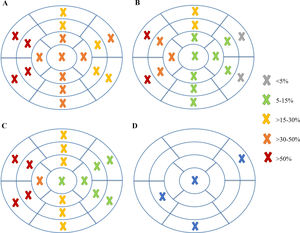 Frequency of late gadolinium enhancement in each myocardial segment in patients with ventricular arrhythmia (VA) (A), without VA (B) and in the general population (C). D depicts the set of arrhythmogenic segments.
