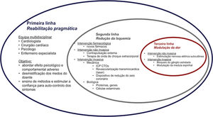 Abordagem e opções terapêuticas para a angina refratária (CTO ‐ oclusão crónica, ICP ‐ intervenção coronária percutânea).