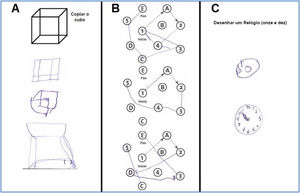 Examples of patient performance in assessing visuospatial executive domain (A: Copy the cube; B: Complete the sequence; C: Draw a clock: 11:10).