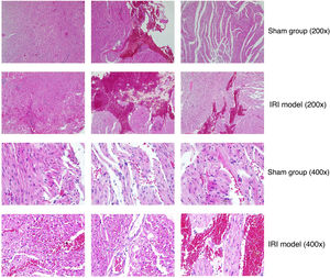 Comparison of myocardial tissues from rats in the sham group and rats of the myocardial ischemia-reperfusion injury (IRI) model. Representative images are shown at 200× and 400× magnification (hematoxylin and eosin staining). In specimens from myocardial IRI rats, the ischemic region showed focal attenuation of sarcoplasm and focal loss of striations. Hyperemic blood vessels and extravasation of erythrocytes were observed in muscle fibers in the sham group to a lesser extent than in the myocardial IRI model.