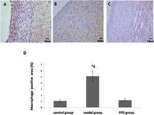 Observation of macrophage expression in the vascular intimal with immunohistochemical staining. The scale bar=50 μm. (A), Control group, (B) model group, and (C) Pirfenidone (PFD) group. (D), Bar graph showing increased macrophage expression in arteries of control group, model group and PFD group. Values are represented as mean±SD (n=10). p<0.05 indicates a significant difference. *p<0.05, compared with control group. #p<0.05, compared with model group.