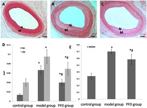 Intimal hyperplasia of each group at 14 weeks of arterial injury. Forty magnification photomicrographs (hematoxylin and eosin and Van Gieson elastin stain) of arterial sections from control group (A), model group (B), and PFD group (C). Note thicker intimal in model group. (D), Bar graph shows neointima formation of each group. (E), Bar graph shows the ratio between neointimal and media area of each group. The scale bar=1 mm. Values are represented as mean±SD (n=10). p<0.05 indicates a significant difference. *p<0.05, compared with control group. #p<0.05, compared with model group. N, intimal, M, media.