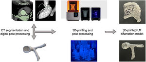 Workflow of 3D models of LM bifurcation. CT images of normal coronary arteries were segmented creating a digital model of the coronary arteries. Then, an eccentric stenosis was created in ostial LAD and a connector to the simulator aorta was added. Wall thickness of 0.5 mm was used and supports were added for 3D printing with elastic resin using stereolithography. Five identical 3D prints of LM bifurcation were obtained after post-processing.