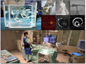 Workflow of simulated interventional and intravascular imaging procedure. The 3D printed LM anatomies were connected to SimulHeart interventional cardiology simulator (top left panel) and the procedures were undertaken under video camera visualization, fluoroscopy and using OCT, IVUS and IVUS HD intravascular imaging (top right panels). The procedures were done in a real catheterization laboratory using real interventional devices and clinical used consoles (bottom panel).