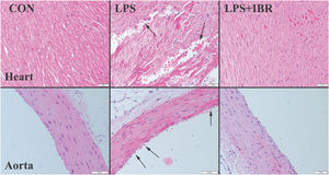 Representative microscopic images of the heart and aorta in the three groups showing loss of and injury to endothelial cells, as well as damage to elastic fibers (arrows) in the LPS group. CON: control; LPS: lipopolysaccharide; LPS+IBR: lipopolysaccharide and irbesartan.
