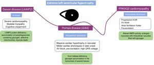 Differential diagnosis in the presence of severe hypertrophic cardiomyopathy. AV: atrioventricular; AMPK: adenosine monophosphate-activated protein kinase; GAA: acid alpha-glucosidase; HCM: hypertrophic cardiomyopathy.