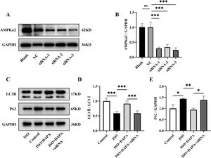 AMPKα2 knockdown attenuated the promotion of mitophagy by dapagliflozin. (A) Representative Western blots of AMPKα2. (B) Quantitative analysis of the expression levels of AMPKα2. (C) Representative Western blots of LC3B and P62. (D and E) Quantitative analysis of the expression levels of LC3B and P62. Results were presented as mean±SD (n=3 for each group). *p<0.05, **p<0.01, ***p<0.001; ns, not significant.