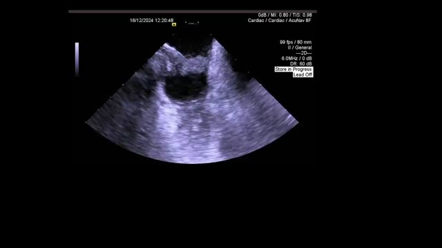 https://ars.els-cdn.com/content/image/1-s2.0-S0870255125003130-mmc2.mp4