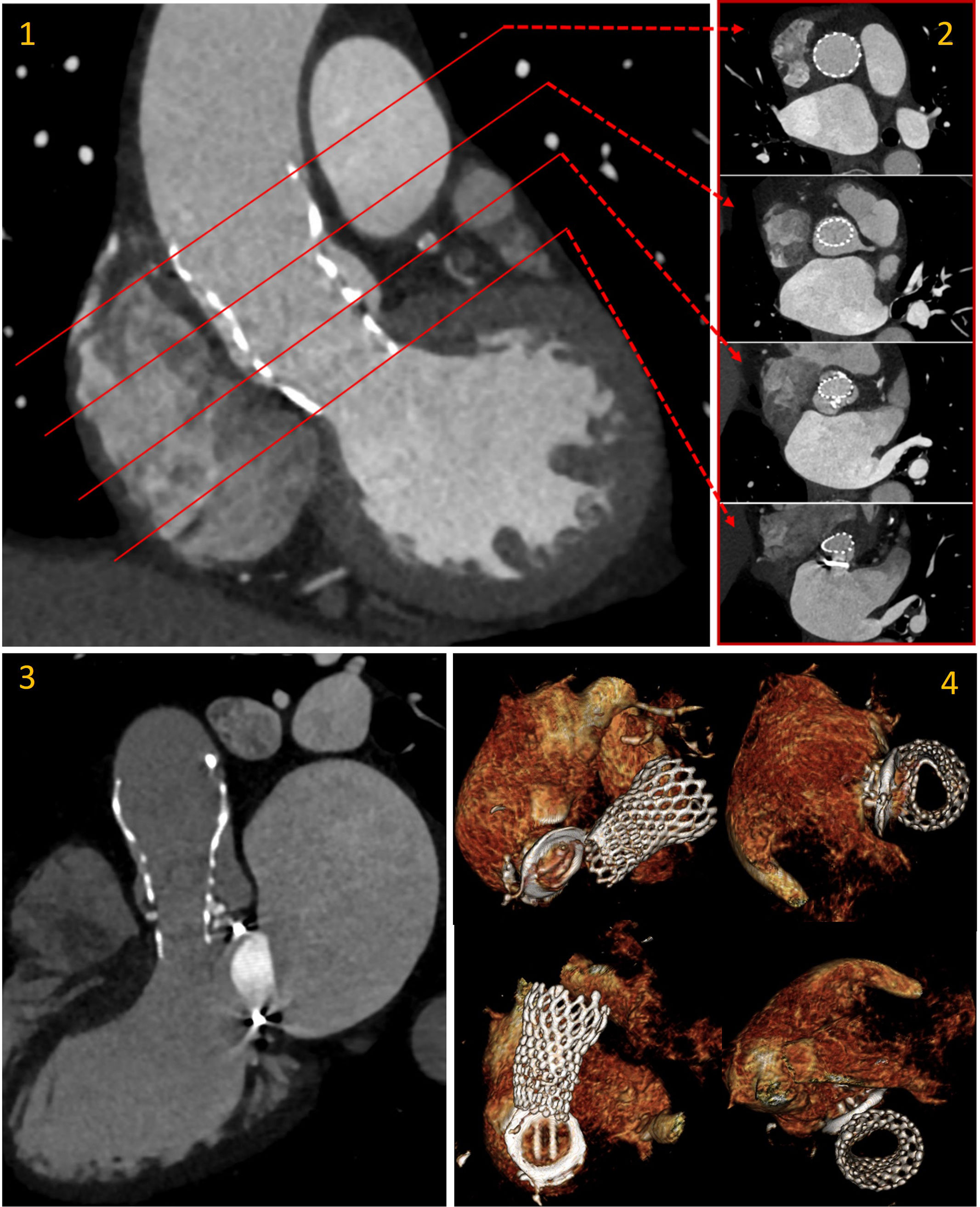 fig0005