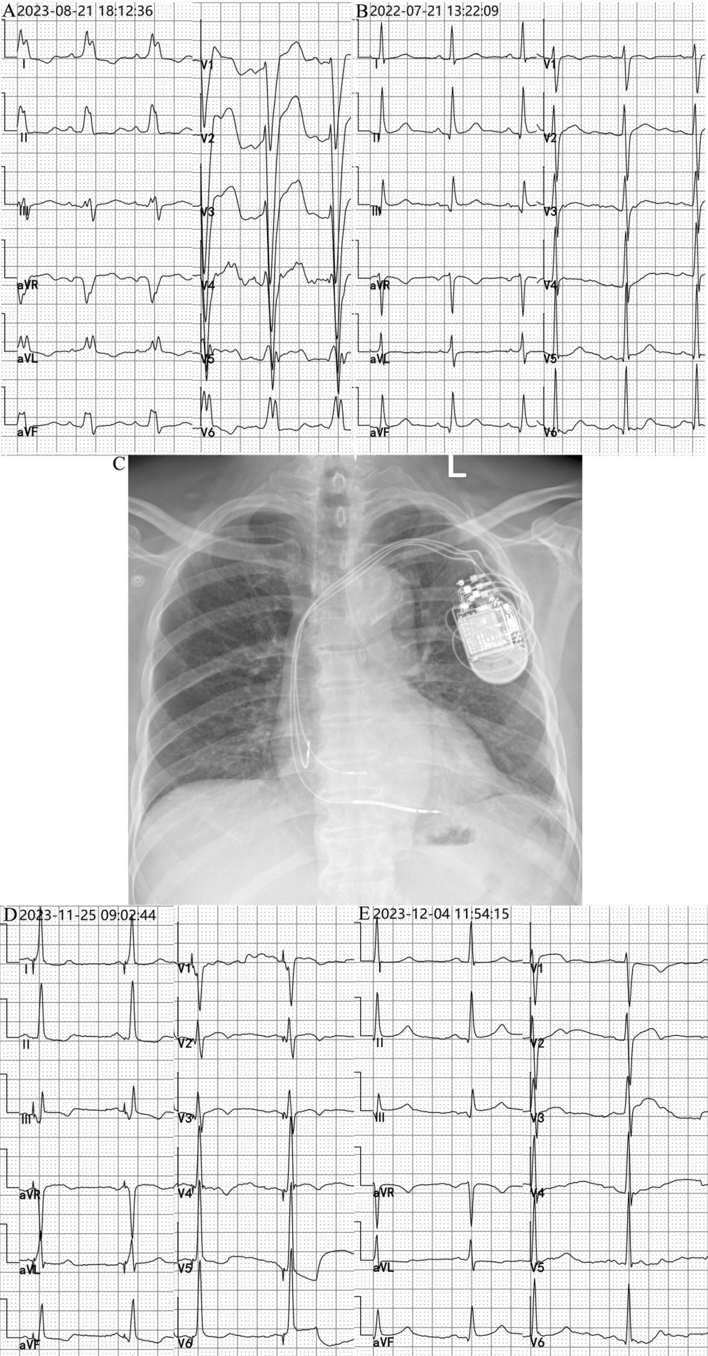 fig0005