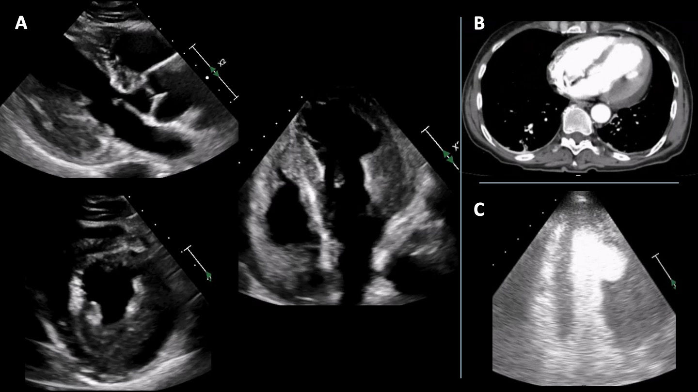 fig0005