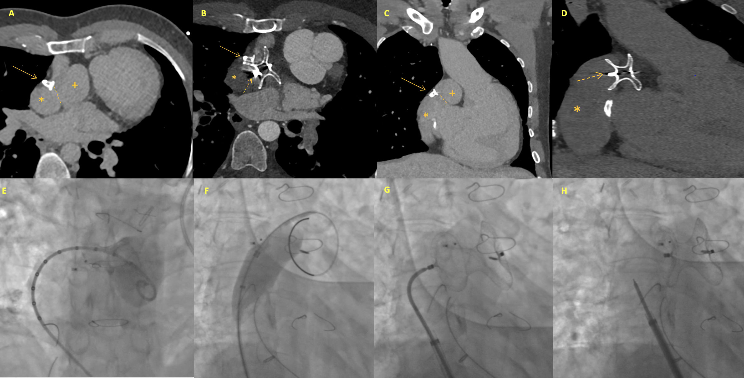 fig0005