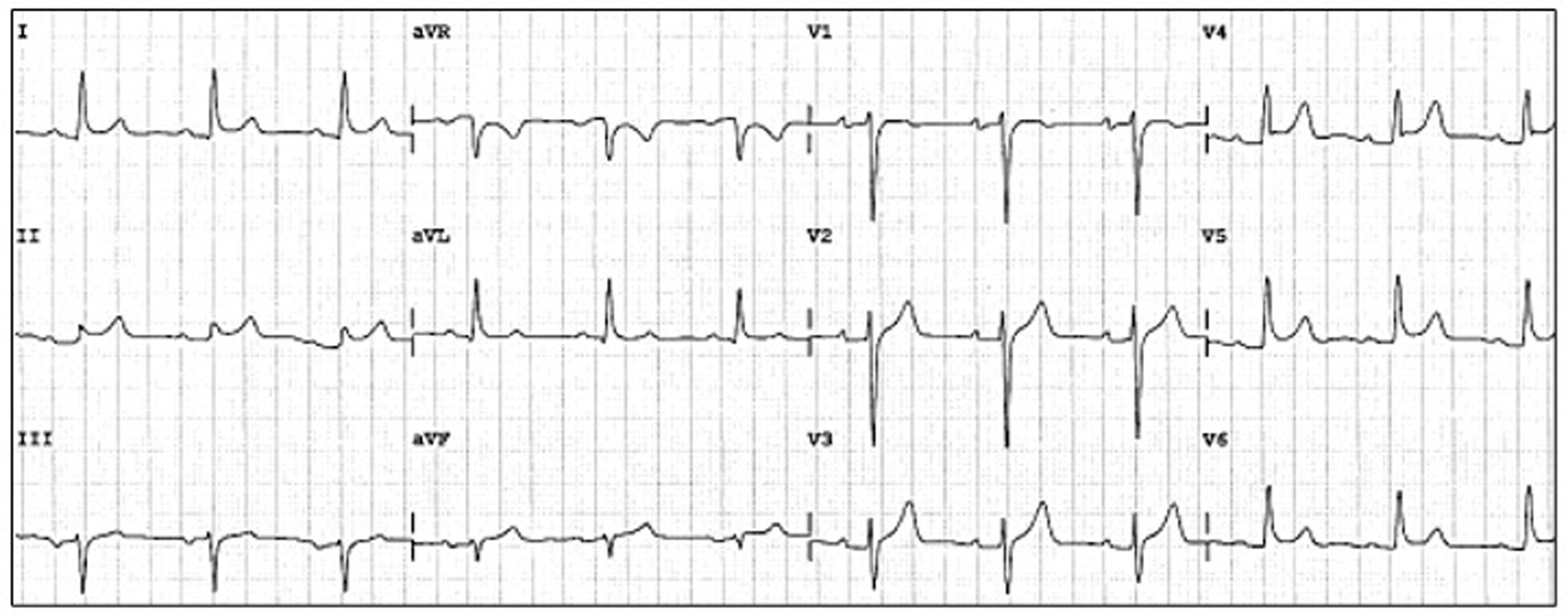 fig0010