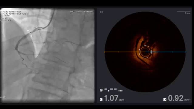 https://ars.els-cdn.com/content/image/1-s2.0-S0870255126002052-mmc1.mp4