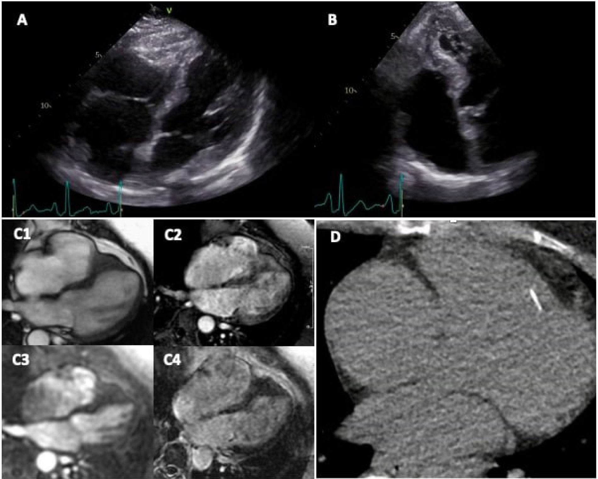 fig0005