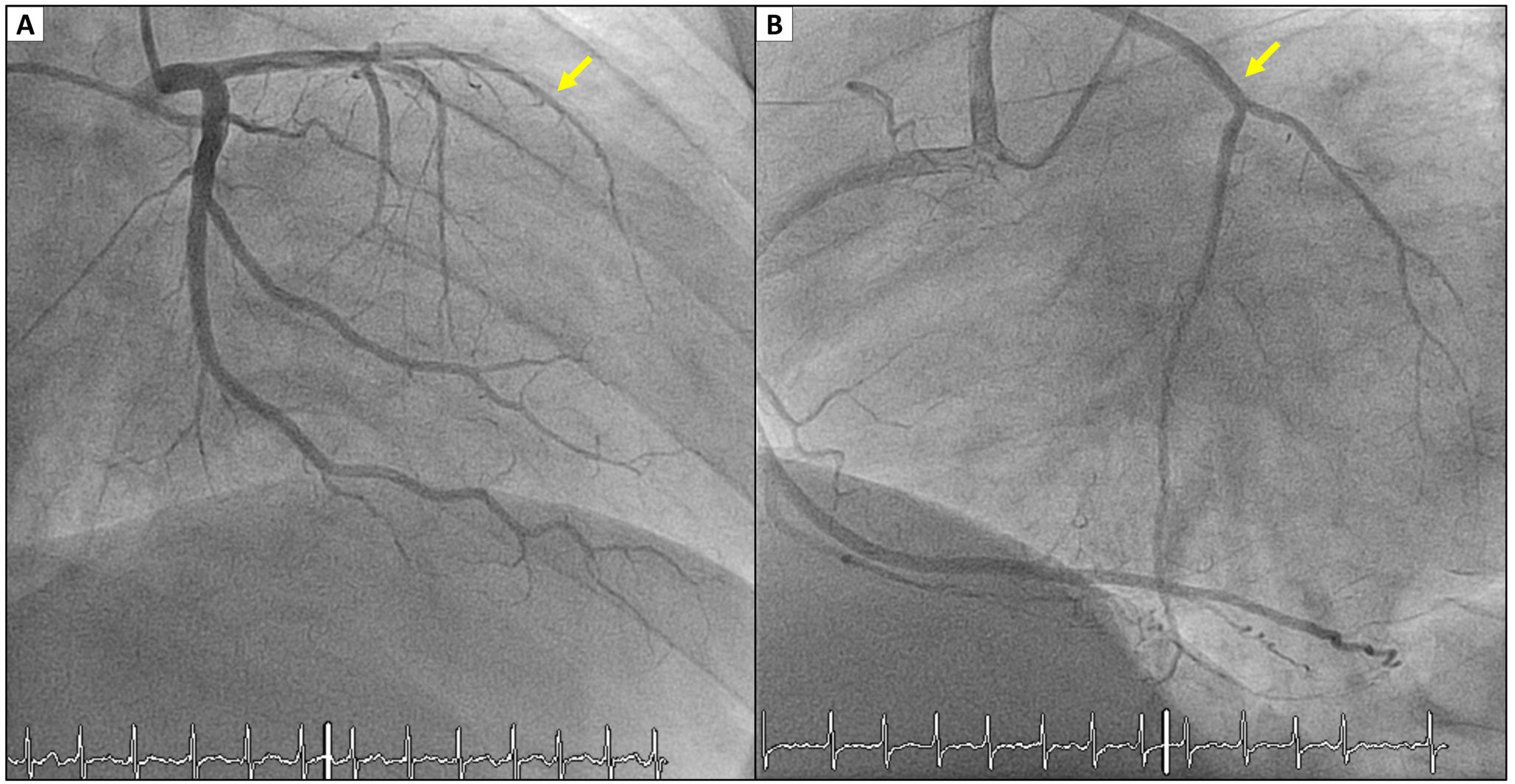 fig0005
