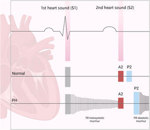 Cardiac auscultation findings suggestive of pulmonary hypertension. PH: pulmonary hypertension; PR: pulmonary regurgitation; TR: tricuspid regurgitation.