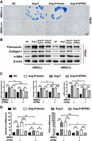 The fibrosis of Ang II-treated rCFBs was inhibited by rMSCs or higher levels of SFRS3. (A) Masson