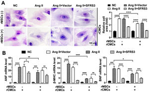 Ang II-triggered hypertrophy of rCMCs was mitigated by rMSCs or SFRS3 overexpression. (A) H&E staining showing the morphology of rCMCs with indicated treatments. (B) qPCR results showing the expression of ANF, β-MHC, and BNF in rCMCs with indicated treatments. The NC group indicated that the cells were treated without any treatment, the Ang II group indicated that the cells were treated with Ang II, the Ang II+Vector group indicated that the cells were transferred to empty plasmid based on the Ang II treatment and the Ang II+SFRS3 group indicated that the SFRS3 plasmid was transferred after Ang II treatment. *p<0.05; **p<0.01; ***p<0.001; ****p<0.0001.