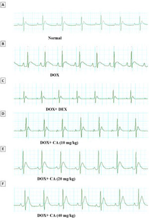 Representative electrocardiogram images of various groups. (A) Normal, (B) DOX, (C) DOX+DEX, (D) DOX+chelidonic acid (10 mg/kg), (E) DOX+chelidonic acid (20 mg/kg), and (F) DOX+chelidonic acid (40 mg/kg)] (n=7).