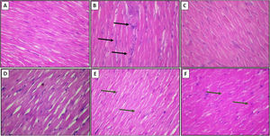 Effect of chelidonic acid on hematoxylin and eosin staining. (A) Normal, (B) DOX, (C) DOX+DEX, (D) DOX+chelidonic acid (10 mg/kg), (E) DOX+chelidonic acid (20 mg/kg), and (F) DOX+chelidonic acid (40 mg/kg) (n=7), black arrows indicated the damage and cell infiltration, while green arrows indicate the protection against myocardial damage.