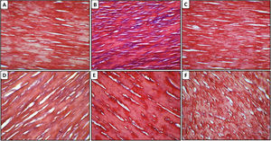 Effect of chelidonic acid on fibrosis (Masson