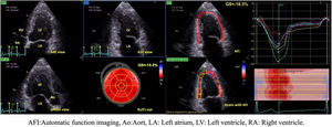 Calculation of GLS with AFI.