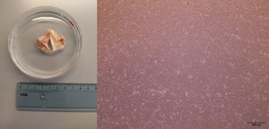 Representative image of an excised aortic valve (left) and isolated valve interstitial cells (right) in culture. Cells were imaged at 40× magnification. Scale bar: 500 μm.