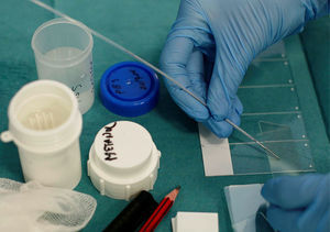 Transbronchial needle aspiration slide preparation.