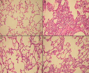Histological H & E stained sections (200×) representative of control (A), BLM+placebo (B), BLM+iloprost (C), BLM+methyl-prednisolone (D).