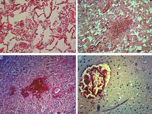 Microscopic polivisceral haemorrhages: (A) lung; (B) heart; (C) kidney; and (D) brain.