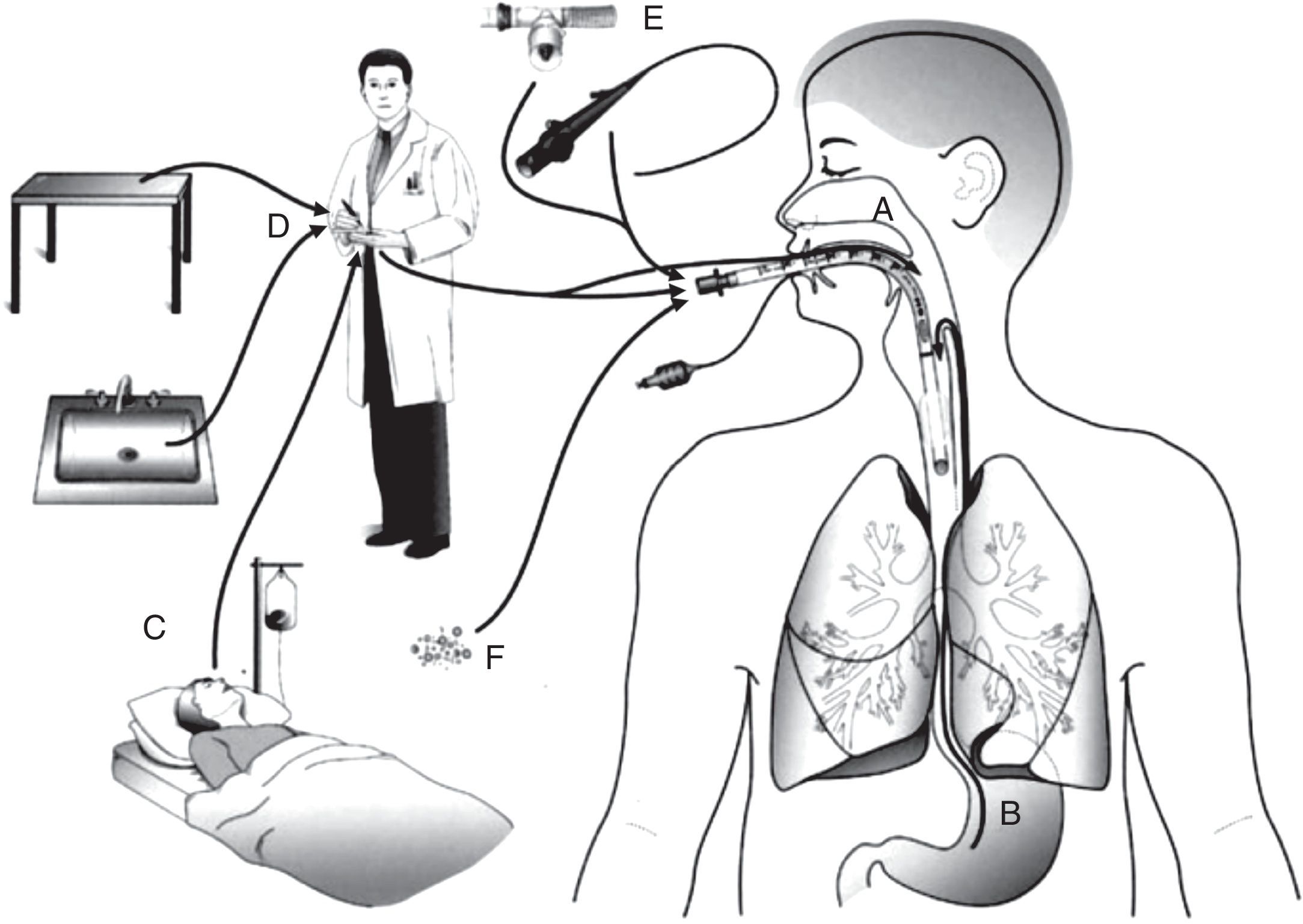 Prevention of ventilator-associated pneumonia | Pulmonology