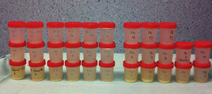 Sequential samples of bilateral WLLs.