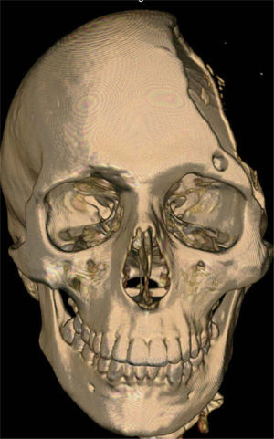 Tomografía computarizada (TC) frontal del paciente.