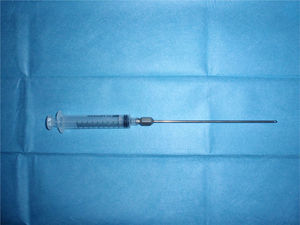 Cánula de liposucción conectada a jeringa de 10cc para succión a bajas presiones negativas.