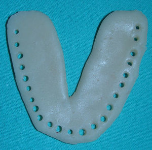 Platina en forma de herradura, con perforaciones en su periferia que sirven para fijar la sutura que la unirá a la lengua.