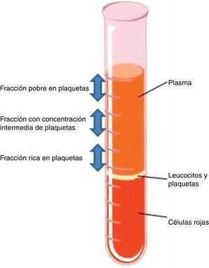 Fases obtenidas tras la centrifugación de sangre anticoagulada.