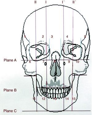 El esquema muestra la ubicación de los planos horizontales A, B y C y de los planos verticales I, I’, II y II’ para delimitar los 15 cuadrantes en que fueron divididos el cráneo y la mandíbula.
