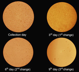 Stem cells culture. The exchange of culture medium was performed every three days until the tenth day.